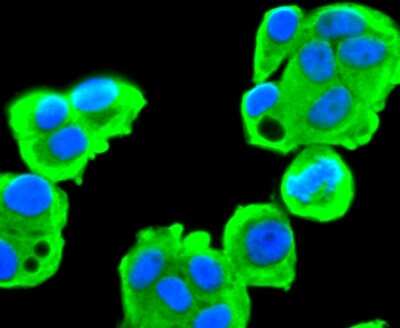 Immunocytochemistry/Immunofluorescence: Fatty Acid Synthase/FASN Antibody (JJ0939) [NBP2-66833] - Staining Fatty Acid Synthase in MCF-7 cells (green). The nuclear counter stain is DAPI (blue). Cells were fixed in paraformaldehyde, permeabilised with 0.25% Triton X100/PBS.