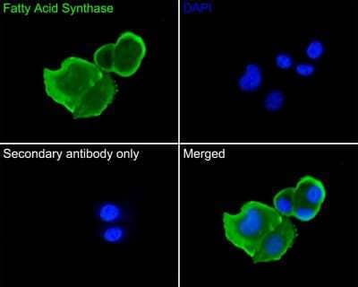 Immunocytochemistry/Immunofluorescence: Fatty Acid Synthase/FASN Antibody (JJ0939) [NBP2-66833] - Analysis of SK-Br-3 cells labeling Fatty Acid Synthase/FASN with Rabbit anti-Fatty Acid Synthase antibody (permeabilized with 0.05% Triton X-100 in PBS for 20 minutes, and then blocked with 2% negative goat serum for 30 minutes at room temperature. Cells were then incubated with Rabbit anti-Fatty Acid Synthase antibody  was used as the secondary antibody at 1/1,000 dilution. PBS instead of the primary antibody was used as the secondary antibody only control. Nuclear DNA was labelled in blue with DAPI.