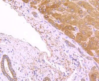 Immunohistochemistry-Paraffin: Fatty Acid Synthase/FASN Antibody (JJ0939) [NBP2-66833] - Analysis of paraffin-embedded human liver tissue using anti-Fatty Acid Synthase antibody. Counter stained with hematoxylin.