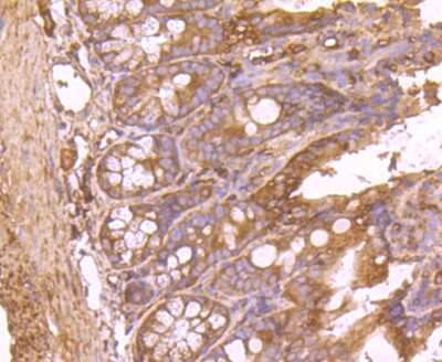 Immunohistochemistry-Paraffin: Fatty Acid Synthase/FASN Antibody (JJ0939) [NBP2-66833] - Analysis of paraffin-embedded mouse colon tissue using anti-Fatty Acid Synthase antibody. Counter stained with hematoxylin.