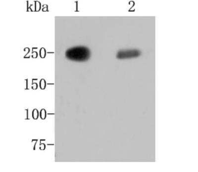 Western Blot: Fatty Acid Synthase/FASN Antibody (JJ0939) [NBP2-66833] - Analysis of Fatty Acid Synthase on different lysates. Proteins were transferred to a PVDF membrane and blocked with 5% BSA in PBS for 1 hour at room temperature. The primary antibody (1/500) was used in 5% BSA at room temperature for 2 hours. Goat Anti-Rabbit IgG - HRP Secondary Antibody at 1:5,000 dilution was used for 1 hour at room temperature. Positive control: Lane 1: MCF-7 cell lysateLane 2: SW480 cell lysate