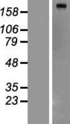 Western Blot: Fatty Acid Synthase Overexpression Lysate (Adult Normal) [NBP2-10566] Left-Empty vector transfected control cell lysate (HEK293 cell lysate); Right -Over-expression Lysate for Fatty Acid Synthase.