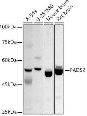 Western Blot: Fatty acid desaturase 2 Antibody [NBP3-03260] - Analysis of extracts of various cell lines, using FADS2 antibody at 1:1000 dilution. Secondary antibody: HRP Goat Anti-Rabbit IgG (H+L)  at 1:10000 dilution.Lysates/proteins: 25ug per lane. Blocking buffer: 3% nonfat dry milk in TBST.Detection: ECL Basic Kit. Exposure time: 10s.