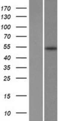 Western Blot: Fatty acid desaturase 2 Overexpression Lysate (Adult Normal) [NBP2-10570] Left-Empty vector transfected control cell lysate (HEK293 cell lysate); Right -Over-expression Lysate for Fatty acid desaturase 2.