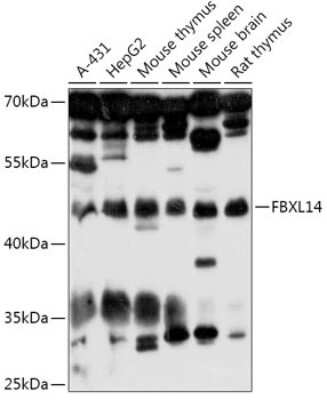 Western Blot: Fbl14 Antibody [NBP3-03482] - Analysis of extracts of various cell lines, using Fbl14 antibody at 1:1000 dilution. Secondary antibody: HRP Goat Anti-Rabbit IgG (H+L) at 1:10000 dilution. Lysates/proteins: 25ug per lane. Blocking buffer: 3% nonfat dry milk in TBST. Detection: ECL Basic