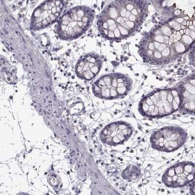 Immunohistochemistry-Paraffin: Fc alpha/mu R Antibody [NBP2-62627] - Staining of human colon shows low expression as expected.