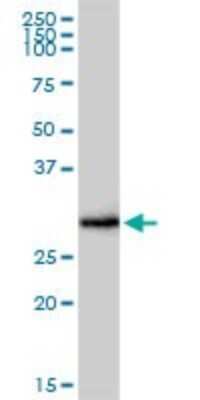 Western Blot: Fc epsilon RI Antibody [H00002205-D01P] - Analysis of FCER1A expression in human kidney.