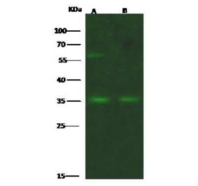 Western Blot: Fc epsilon RI Antibody [NBP3-00092] - Anti-Fc epsilon RI rabbit polyclonal antibody at 1:500 dilution. Lane A: A431 Membrane Lysate. Lane B: 293T Membrane Lysate. Lysates/proteins at 30 ug per lane. Secondary Goat Anti-Rabbit IgG H&L (Dylight 800) at 1/10000 dilution. Developed using the Odyssey technique. Performed under reducing conditions. Predicted band size: 30 kDa. Observed band size: 35 kDa (We are unsure as to the identity of these extra bands).