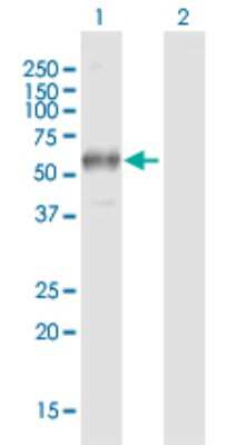 Western Blot: Fc gamma RI/CD64 Antibody [H00002209-B01P] - Analysis of FCGR1A expression in transfected 293T cell line by FCGR1A polyclonal antibody.  Lane 1: FCGR1A transfected lysate(42.60 KDa). Lane 2: Non-transfected lysate.