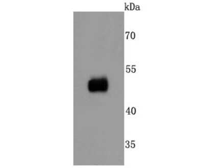 Western Blot: Fc gamma RIIA/CD32a Antibody (JM10-70) [NBP2-66834] - Analysis of CD32 on human lung cells lysates using anti-CD32 antibody at 1/500 dilution.