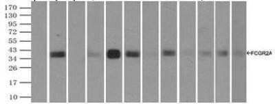 Immunoprecipitation: Fc gamma RIIA/CD32a Antibody (OTI9G5) - Azide and BSA Free [NBP2-70709] - Lane 1: Negative Control Lane 2: NBP1-47738 Lane 3: NBP1-47739 Lane 4: NBP1-47740 Lane 5: NBP1-47741 Lane 6: NBP1-47742 Lane 7: NBP1-47734 Lane 8: NBP1-47735 Lane 9: NBP1-47736 Lane 10: NBP1-47737 Lane 11: NBP1-47743 Lane 12: NBP1-47744