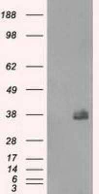 Western Blot: Fc gamma RIIA/CD32a Antibody (OTI9G5) - Azide and BSA Free [NBP2-70709] - HEK293T cells were transfected with the pCMV6-ENTRY control (Left lane) or pCMV6-ENTRY FCGR2A (Right lane) cDNA for 48 hrs and lysed. Equivalent amounts of cell lysates (5 ug per lane) were separated by SDS-PAGE and immunoblotted with anti-FCGR2A.