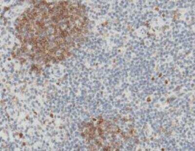 Immunohistochemistry-Paraffin: Fc gamma RIIB/CD32b Antibody (110) [NBP2-89364] - Staining of  human lymphonode showing membrane staining of B cells and some other mononuclear cell (1:10000).