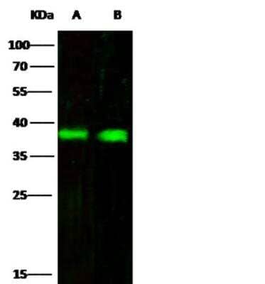 Western Blot: Fc gamma RIIB/CD32b Antibody (110) [NBP2-89364] - Lane A: Daudi Whole Cell Lysate Lane B: THP1 Whole Cell LysateLysates/proteins at 30 ug per lane. Secondary Goat Anti-Rabbit IgG H&L (Dylight800) at 1/10000 dilution. Developed using the Odyssey technique. Performed under reducing conditions. Predicted band size:34 kDa Observed band size:38 kDa