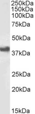 Western Blot: Fc gamma RIIB/CD32b Antibody [NBP1-69757] - Fc gamma RIIB/CD32b antibody (1g/ml) staining of Daudi cell lysate (RIPA buffer, (35g protein in RIPA buffer). Primary incubation was 1 hour. Detected by chemiluminescence.