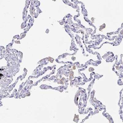 Immunohistochemistry-Paraffin: Fc gamma RIIIA/CD16a Antibody [NBP2-33753] - Staining of human lung shows strong cytoplasmic positivity in macrophages.