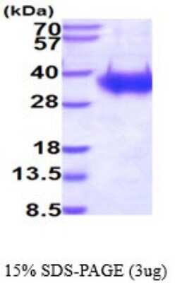 SDS-Page: Recombinant Human Fc gamma RIIIA/CD16a Protein [NBP2-53046] -  15% SDS-PAGE (3ug)
