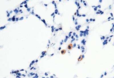 Immunohistochemistry-Paraffin: FcgR4/CD16-2 Antibody (011) [NBP3-05889] - Staining of mouse FCGR4 in mouse lung with rabbit monoclonal antibody (1:200).