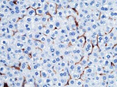 Immunohistochemistry-Paraffin: FcgR4/CD16-2 Antibody (011) [NBP3-05889] - Staining of mouse FCGR4 in mouse liver with rabbit monoclonal antibody (1:200).