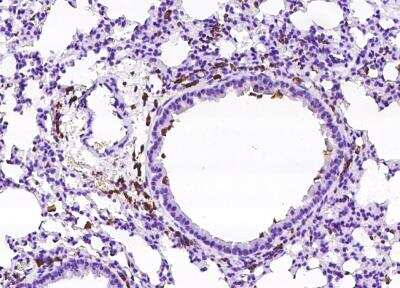 Immunohistochemistry-Paraffin: FcgR4/CD16-2 Antibody [NBP3-05901] - Staining of mouse FCGR4 in mouse lung with rabbit polyclonal antibody at 1:200 dilution.