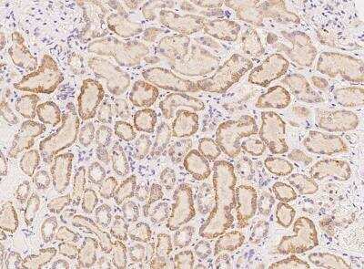 Immunohistochemistry-Paraffin: Fer-1-like protein 6 Antibody [NBP3-05936] - Staining of human FER1L6 in human kidney with rabbit polyclonal antibody at 1:100 dilution.
