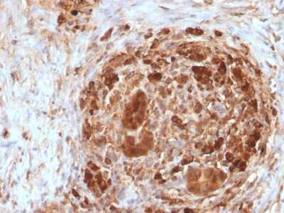 Immunohistochemistry-Paraffin: Ferritin Antibody (FTH/2082) - Azide and BSA Free [NBP3-08613] - Formalin-fixed, paraffin-embedded Human Pancreas stained with Ferritin Mouse Monoclonal Antibody (FTH/2082).