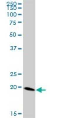 Western Blot: Ferritin Antibody [H00002495-B01P] - Analysis of FTH1 expression in human kidney.