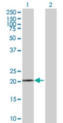 Western Blot: Ferritin Antibody [H00002495-B01P] - Analysis of FTH1 expression in transfected 293T cell line by FTH1 polyclonal antibody.  Lane 1: FTH1 transfected lysate(20.24 KDa). Lane 2: Non-transfected lysate.