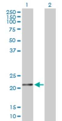 Western Blot: Ferritin Antibody [H00002495-D01P] - Analysis of FTH1 expression in transfected 293T cell line by FTH1 polyclonal antibody.Lane 1: FTH1 transfected lysate(21.20 KDa).Lane 2: Non-transfected lysate.