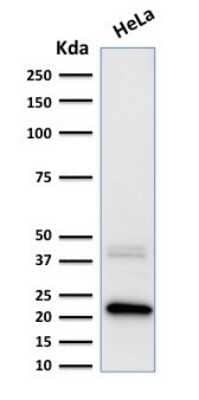 Western Blot: Ferritin Light Chain Antibody (FTL/1389) - Azide and BSA Free [NBP2-54583] - Formalin-fixed, paraffin-embedded human Pancreas stained with Ferritin Light Chain Antibody (FTL/1389).