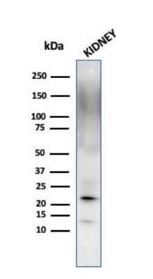 Western Blot: Ferritin Light Chain Antibody (FTL/1389) - Azide and BSA Free [NBP2-54583] - Western Blot Analysis of kidney tissue lysate using Ferritin Light Chain antibody (FTL/1389).