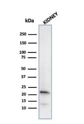 Western Blot: Ferritin Light Chain Antibody (FTL/2338R) - Azide and BSA Free [NBP3-08620] - Western Blot Analysis of human kidney tissue lysate using Ferritin Light Chain Rabbit Recombinant Monoclonal Antibody (FTL/2338R).
