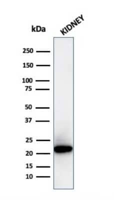 Western Blot: Ferritin Light Chain Antibody (FTL/3872R) - Azide and BSA Free [NBP3-08623] - Western Blot Analysis of human kidney tissue lysate using Ferritin Light Chain Recombinant Rabbit Monoclonal Antibody (FTL/3872R).