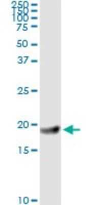 Immunoprecipitation: Ferritin Light Chain Antibody (X3) [H00002512-M18] - Analysis of FTL transfected lysate using anti-FTL monoclonal antibody and Protein A Magnetic Bead, and immunoblotted with FTL rabbit polyclonal antibody.