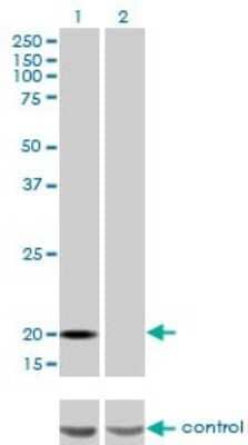 Western Blot: Ferritin Light Chain Antibody (X3) [H00002512-M18] - Analysis of FTL over-expressed 293 cell line, cotransfected with FTL Validated Chimera RNAi (Cat # H00002512-R01V ) (Lane 2) or non-transfected control (Lane 1). Blot probed with FTL monoclonal antibody (M18), clone X3 (Cat # H00002512-M18). GAPDH ( 36.1 kDa ) used as specificity and loading control.