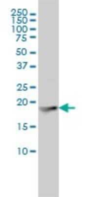Western Blot: Ferritin Light Chain Antibody (X3) [H00002512-M18] - Analysis of FTL expression in K-562 (Cat # L009V1).