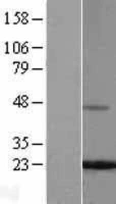 Western Blot Ferritin Light Chain Overexpression Lysate