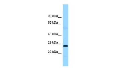 Western Blot: Ferritin mitochondrial Antibody [NBP2-86630] - WB Suggested Anti-FTMT Antibody. Titration: 1.0 ug/ml. Positive Control: Placenta