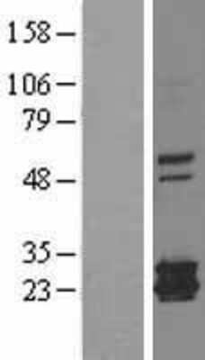 Western Blot: Ferritin mitochondrial Overexpression Lysate (Adult Normal) [NBL1-10852] Left-Empty vector transfected control cell lysate (HEK293 cell lysate); Right -Over-expression Lysate for Ferritin mitochondrial.