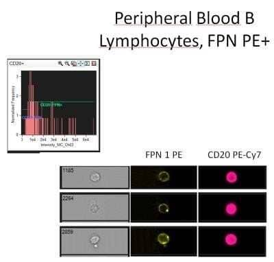 Analysis using the PE conjugate of Ferroportin/SLC40A1 Antibody. Staining of Ferroportin in human B lymphocytes in peripheral blood using PE conjugated anti-Ferroportin/SLC40A1 antibody. Image from verified customer review.