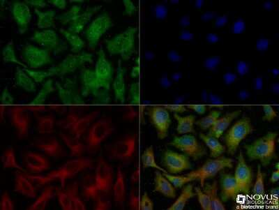 HepG2 cells were fixed and permeabilized for 10 minutes using -20C MeOH. The cells were incubated with Ferroportin/SLC40A1 Antibody at 5.0 ug/ml overnight at 4C and detected with an anti-rabbit DyLight 488 (green) at a 1:500 dilution. Alpha tubulin (DM1A) [NB100-690] was used as a co-stain at a 1:1000 dilution and detected with an anti-mouse DyLight 550 (red) at a 1:500 dilution. Nuclei were counterstained with DAPI (blue). Cells were imaged using a 40X objective.