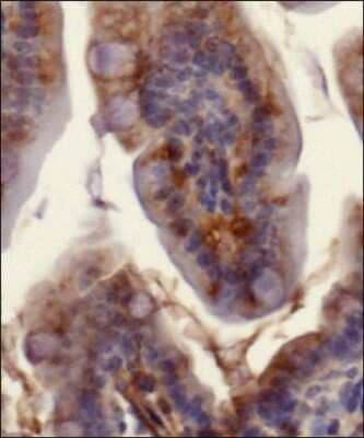 Detection of Ferroportin/SLC40A1 protein in murine small intestinal section using Ferroportin/SLC40A1 Antibody at a dilution of 1:200. The antibody primarily developed a membranous staining pattern in the intestinal epithelial cells.