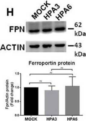 HepG2 clones overexpressing heparanase showed a reduction of hepcidin expression and indices of iron loading. Two stable clones of HepG2 cells transfected with pcDNA3.1-HPA (HPA3 and HPA6) were analyzed for hepcidin expression, BMP/SMAD signaling and indices of iron status. Western blot of Ferroportin/SLC40A1 and its densitometry. The values are expressed as-dCt (for HPA mRNA) or as fold change over the control (MOCK) (for hepcidin and Id1 mRNA). The images are representative from three different analyses. Image collected and cropped by CiteAb from the following publication (//dx.plos.org/10.1371:journal.pone.0164183), licensed under a CC-BY license.