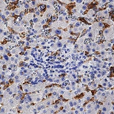 Immunohistochemistry-Paraffin: Ferroportin/SLC40A1 Antibody (1308C) - Azide and BSA Free [NBP2-80731] - Ferroportin/SLC40A1 was detected in immersion fixed paraffin-embedded sections of human liver using Rabbit Anti-Human Ferroportin/SLC40A1 Antibody (1308C) (Catalog # NBP2-75923) at 1 ug/mL for 1 hour at room temperature followed by incubation with the Ant