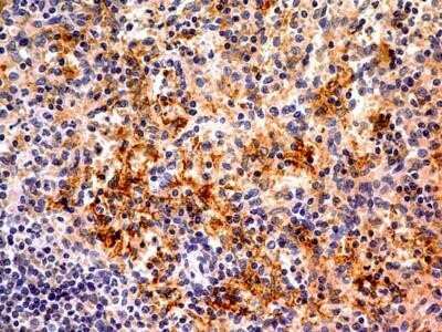 Immunohistochemistry: Ferroportin/SLC40A1 Antibody (8G10NB) - Azide Free [NBP2-45357] - Analysis of a FFPE human spleen section using mouse monoclonal Ferroportin/SLC40A1 Antibody (8G10NB) at 5 ug/ml concentration with HRP-DAB detection followed by hematoxylin counterstaining. The antibody generated membrane cytoplasmic staining in several c
