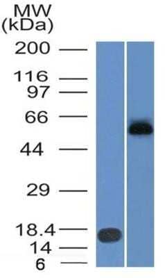 Western Blot: Ferroportin/SLC40A1 Antibody (8G10NB) - Azide Free [NBP2-45357] - Analysis using Ferroportin/SLC40A1 Antibody (8G10NB) in (A) recombinant human Ferroportin protein at 0.5 ug/ml (Molecular weight: 62.5 KDa) and (B) NCCIT lysate at 2 ug/ml. Image from the standard format of this antibody.