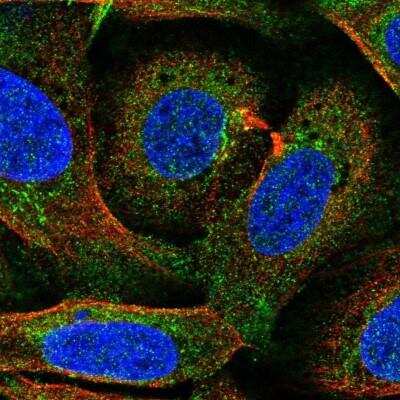 Immunocytochemistry/Immunofluorescence: Ferroportin/SLC40A1 Antibody [NBP2-49454] - Staining of human cell line U-2 OS shows localization to plasma membrane & cytosol. Ferroportin/SLC40A1 Antibody staining is shown in green.