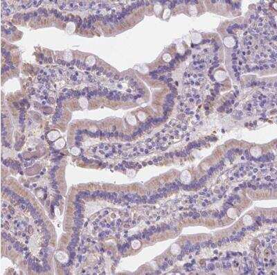 Immunohistochemistry-Paraffin: Ferroportin/SLC40A1 Antibody [NBP2-49454] - Staining of human duodenum using Ferroportin/SLC40A1 Antibody shows weak cytoplasmic positivity in glandular cells.