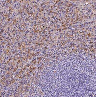 Immunohistochemistry-Paraffin: Ferroportin/SLC40A1 Antibody [NBP2-49454] - Staining of human spleen using Ferroportin/SLC40A1 Antibody shows weak to moderate cytoplasmic positivity in cells in red pulp.