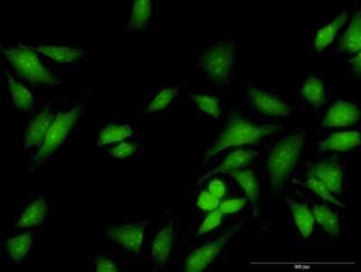 Immunocytochemistry/Immunofluorescence: Fes Antibody [H00002242-B01P] - Analysis of purified antibody to FES on HeLa cell. (antibody concentration 40 ug/ml)